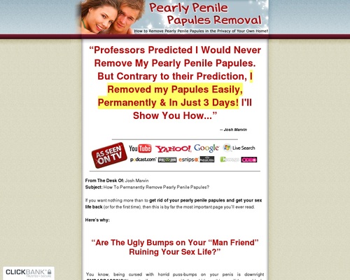 Pearly Penile Papules Removal – How to Remove Pearly Panile Papules at Home