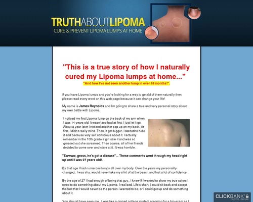 Truth About Lipoma by James Reynolds